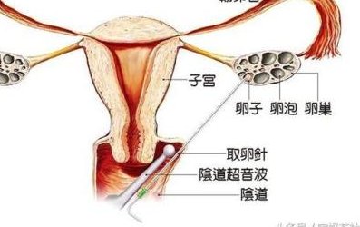 2026南京试管医院三代试管婴儿成功率解析，十大关键参考因素