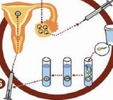 (广州市哪个医院可以做试管的)广州试管成功率高的医院