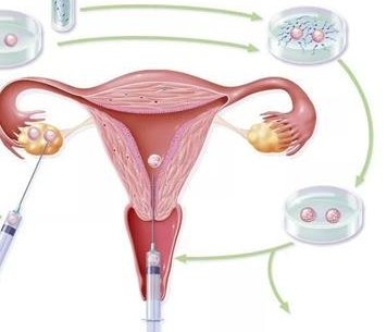 2026太原助孕行业翘楚榜单：十大权威机构大揭秘！